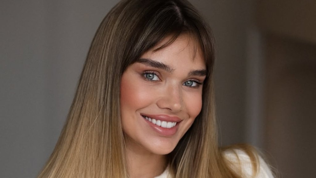 Саша Бо показала неочікувані наслідки підтяжки обличчя: "Випало майже все волосся" (ФОТО)