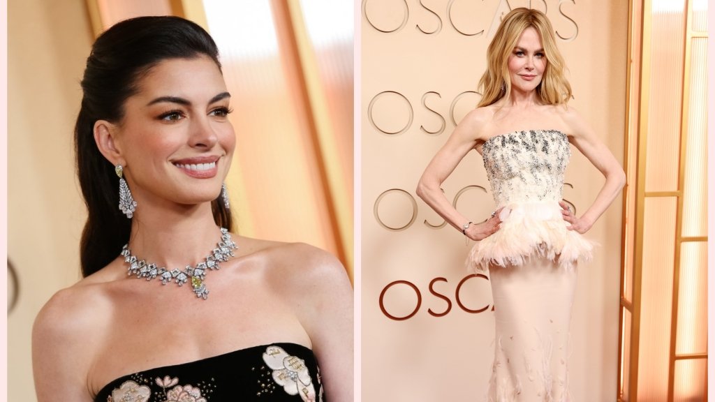 Это фиаско... Самые худшие образы звезд на Оскаре 2026 (ФОТО)