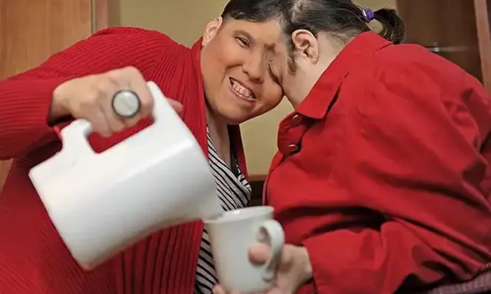 Сиамские близнецы шапелла. Сиамские близнецы шапелла. Лори и джордж шаппели. Доминиканские близнецы. Бластопатия сиамские близнецы.