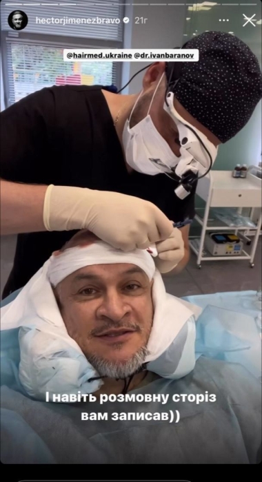 Ектор Хіменес-Браво зробив пересадку волосся і розповів, як минула його операція (ФОТО) - фото №3