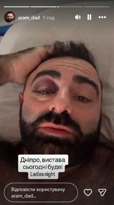 Арам Арзуманян в больнице после падения со сцены