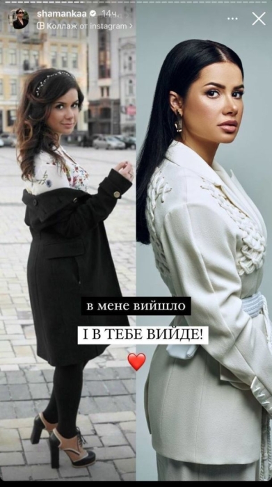 Алина Шаманская показала, как изменилась ее внешность после ряда пластических операций: фото до и после - фото №1