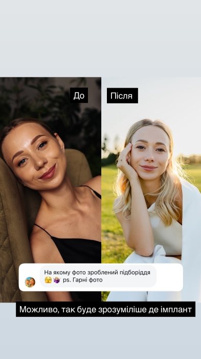 Катерина Репяхова показала результат “до” та “після”