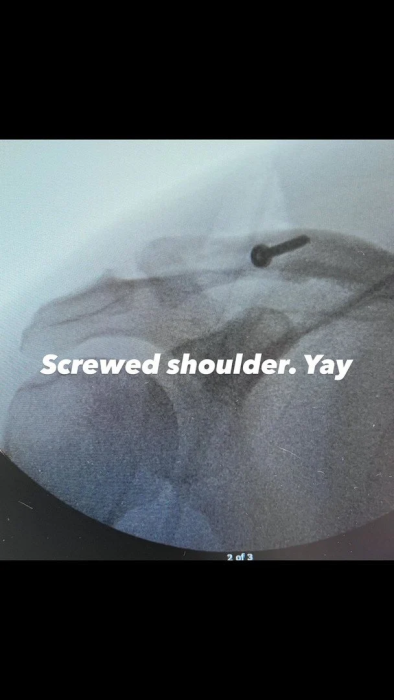 Ченнінг Татум у лікарні після операції