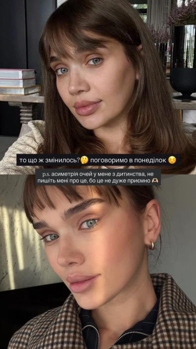 Саша Бо до подтяжкм, фото