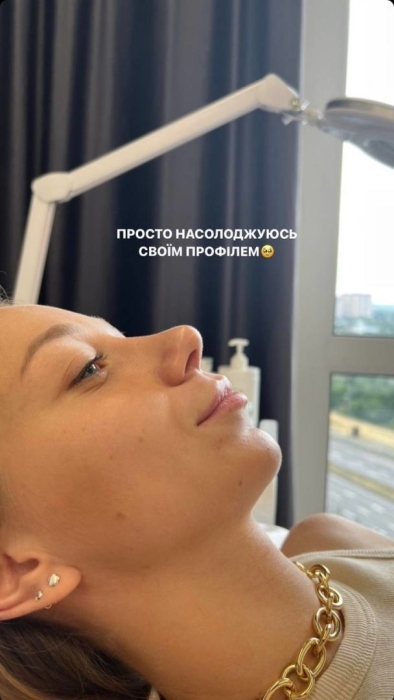 Жена Виктора Павлика второй раз увеличила губы: как теперь выглядит Екатерина Репяхова (ФОТО) - фото №1