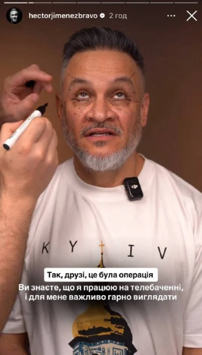 Эктор Хименес-Браво после операции.