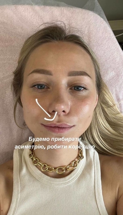 Жена Виктора Павлика второй раз увеличила губы: как теперь выглядит Екатерина Репяхова (ФОТО) - фото №2
