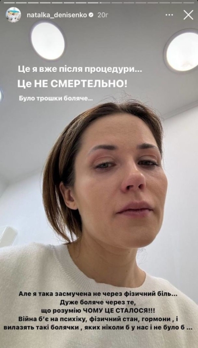 Заплаканная Наталка Денисенко сообщила об экстренной операции на груди - фото №2