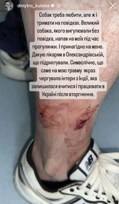 Жахливий інцидент. На Дмитра Кулебу та його улюбленців напав пес: міністр показав глибокі рани від укусів (ФОТО) - фото №1