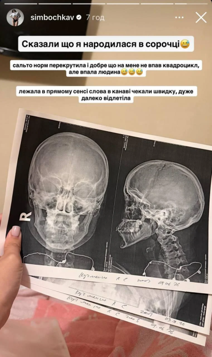 Сімбочка перенесла операцію, фото