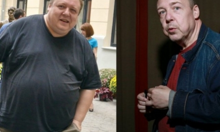 Актер Александр Семчев похудел на 100 килограммов: теперь ему нужна операция
