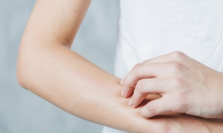 Body-акне: как справиться с высыпаниями на теле