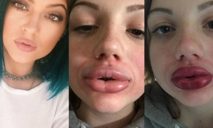Когда флешмоб становится опасным: подростки начали увеличивать губы, как у Кайли Дженнер