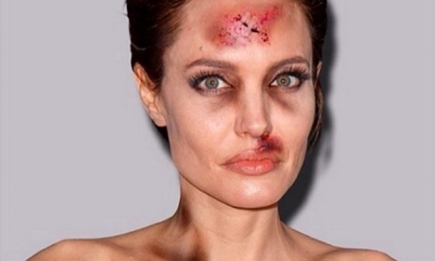 Кто избил Анджелину Джоли и Мадонну: шокирующие фото звезд