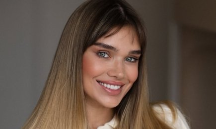 Саша Бо показала неочікувані наслідки підтяжки обличчя: "Випало майже все волосся" (ФОТО)