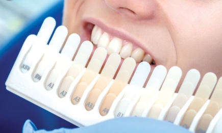 ТОП-5 причин, по которым ваши зубы меняют цвет