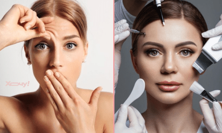 Беспокоят морщины на лбу? Вот как уменьшить их количество в домашних условиях