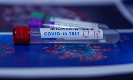 Ученые из Оксфорда разработали новый "пятиминутный" тест на коронавирус
