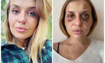 Нападение на Анастасию Луговую в поезде: девушка раскрыла новые подробности ужасного события