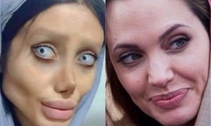 22-летняя девушка сделала 50 пластических операций, чтобы стать похожей на Анджелину Джоли (ФОТО)