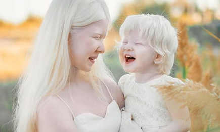 Неземные! Сестры-альбиносы из Казахстана стали востребованными моделями (ФОТО)