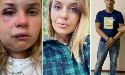 Нападение на Анастасию Луговую в поезде: что надо знать и как сейчас выглядит девушка (ФОТО)