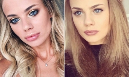 Как жена Никиты Преснякова изменила внешность: Алена Краснова увеличила губы (ФОТО)