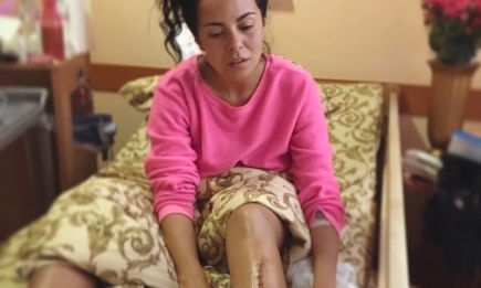 Настя Каменских шокировала тренировками через несколько дней после двух тяжелых операций на ногах (ВИДЕО)