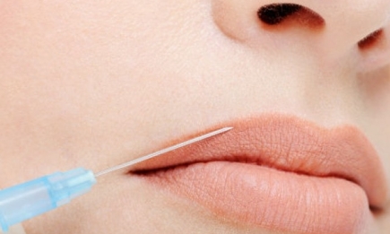 Как увеличить губы с помощью инъекций