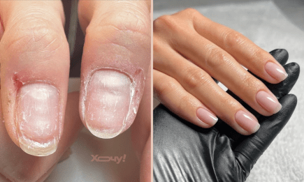 Прочь болезненные заусеницы! Вот как нужно обрезать кутикулу, если вы делаете это самостоятельно