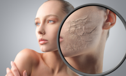 Топ 4 эффективных масок для сухой кожи
