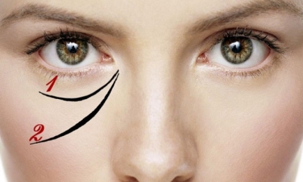 Как убрать морщины вокруг глаз на 100%? Эксперимент редакции журнала ХОЧУ