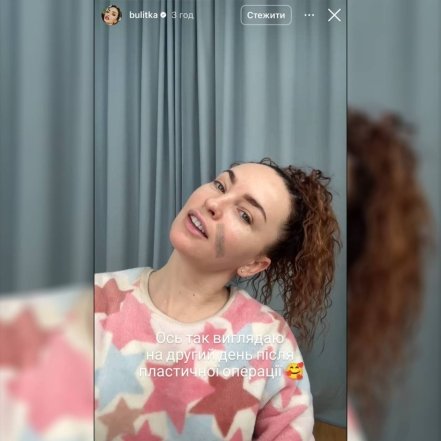Виктория Булитко после пластики, фото
