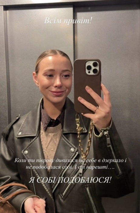 Катерина Репяхова після пластики, фото