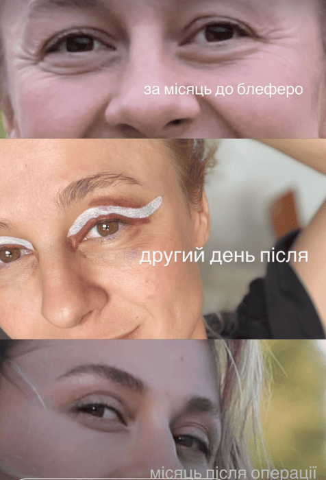 Суддя шоу "МастерШеф" Ольга Мартиновська чесно зізналася у використанні ботоксу