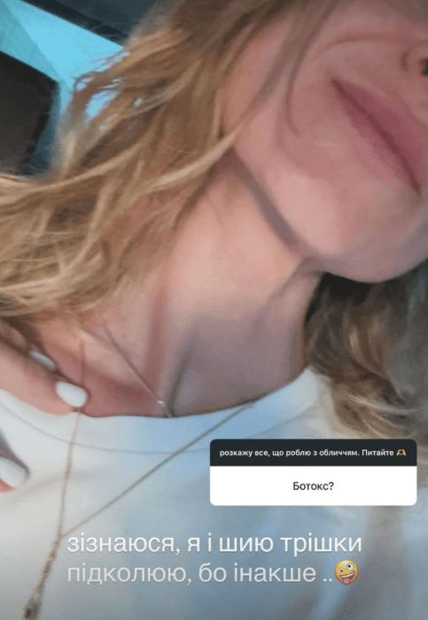 Суддя шоу "МастерШеф" Ольга Мартиновська чесно зізналася у використанні ботоксу