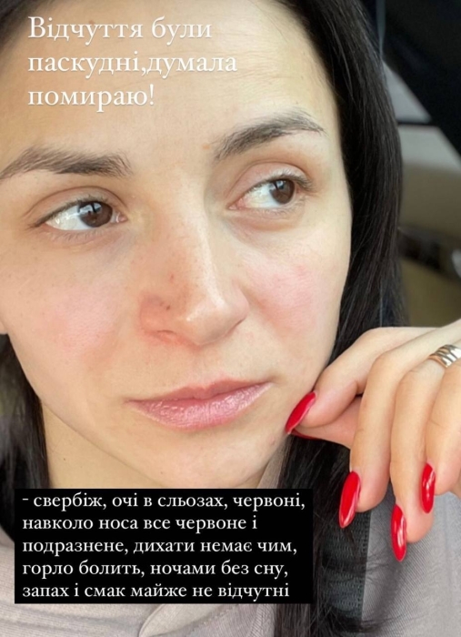 "Це просто жах": Ілона Гвоздьова розповіла про проблеми зі здоров’ям - фото №3