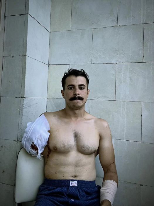 Сын ведущего Грубича вышел на связь после потери руки