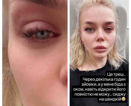 Певица Алина Гросу попала в скорую помощь