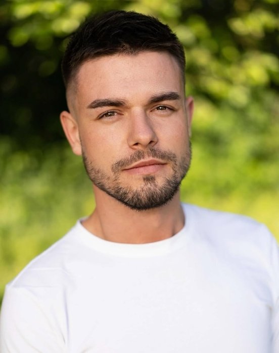 Проблемна шкіра у чоловіків: Ігор Целип - відверте зізнання про спадковість та догляд