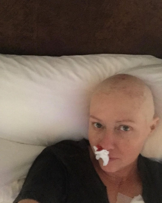 Онкобольная звезда "Зачарованных" Шэннен Доэрти поделилась душераздирающим фото после химиотерапии - фото №1