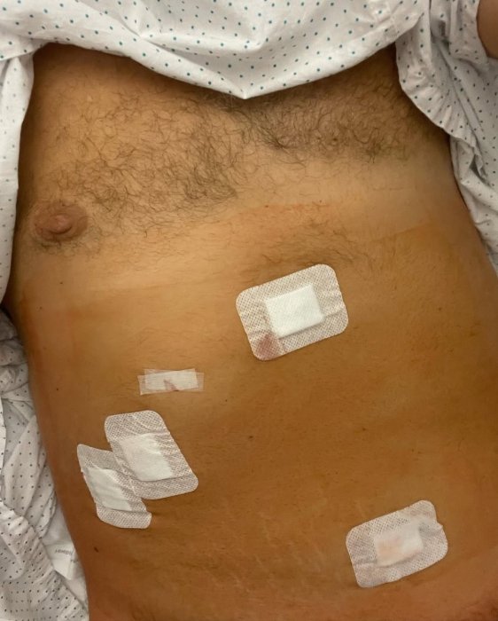 Потап пожаловался на состояние здоровья - рэпер перенес операцию - фото Потап перенес операцию и готовится к новым концертам