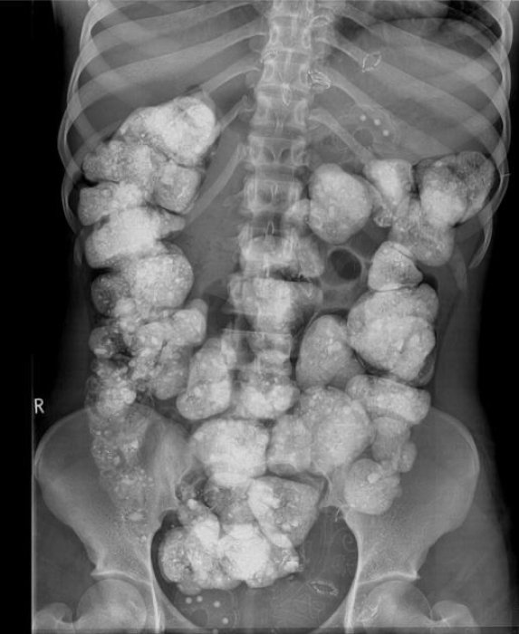 Смешные комментарии под рентгеном