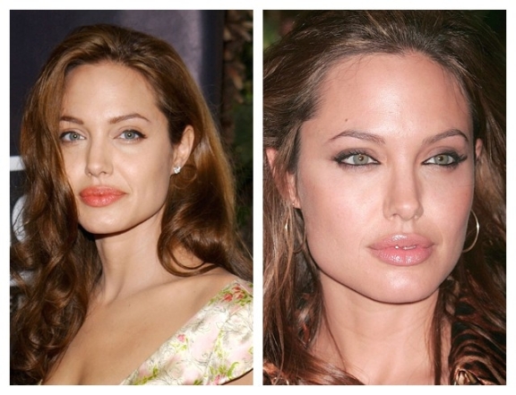 Beauty-эволюция: как менялась внешность Анджелины Джоли (ФОТО) - фото №7