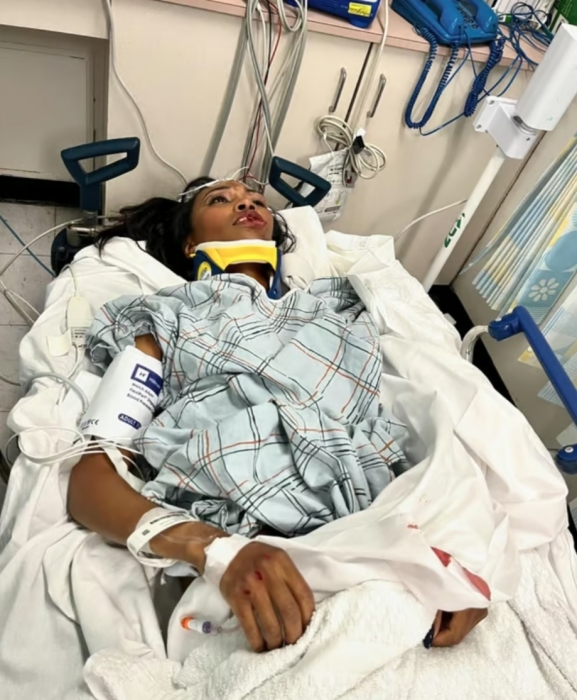 Сломанные кости и ссадины на лице: Керри Бернанс сообщила о своем состоянии после ДТП (ФОТО) - фото №2