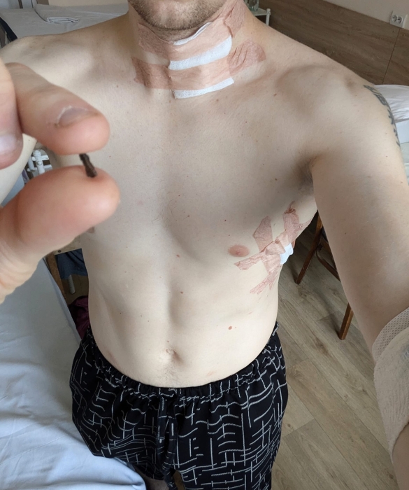 Станислав Асеев получил осколочное ранение