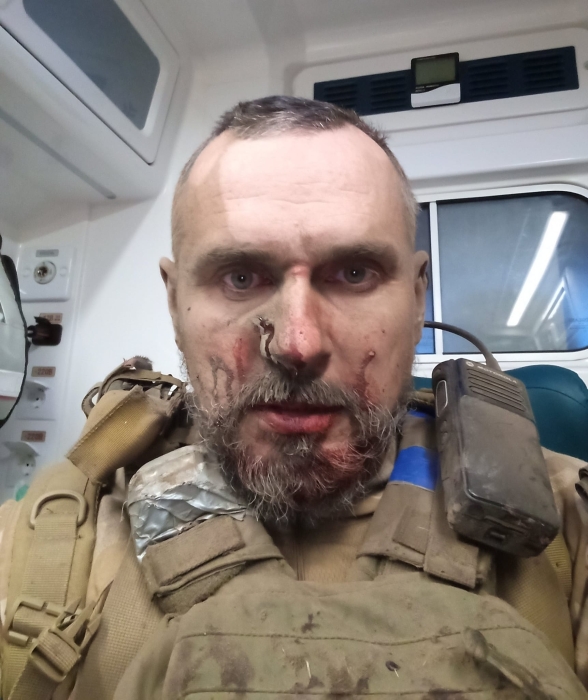После госпитализации Олег Сенцов вернулся на фронт и сразу попал под обстрел: что известно - фото №1