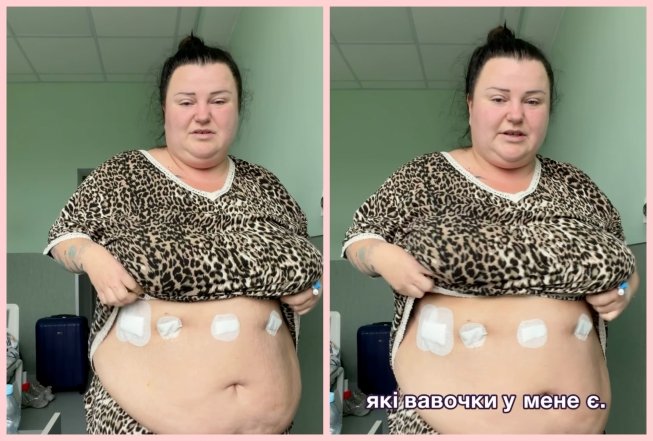 Alyona Alyona уменьшила желудок, фото