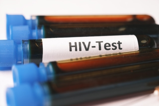 Как часто нужно проходить тест на ВИЧ